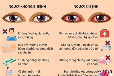 BÀI TUYÊN TRUYỀN BỆNH ĐAU MẮT ĐỎ
